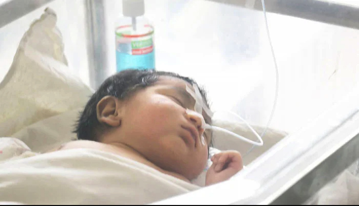 ট্রাকে পিষ্ট মায়ের পেটচিরে ভূমিষ্ঠ শিশুর চিকিৎসায় মেডিকেল বোর্ড