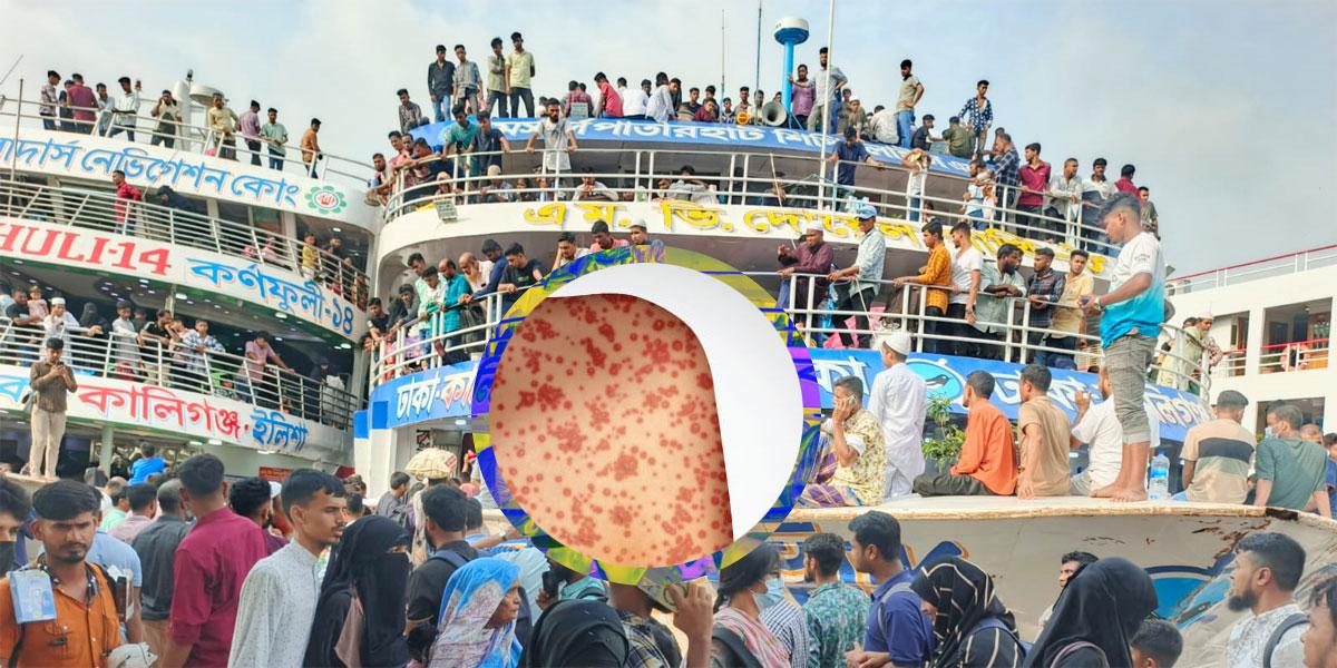 ঈদযাত্রায় হাম সংক্রমণের ঝুঁকি বেশি