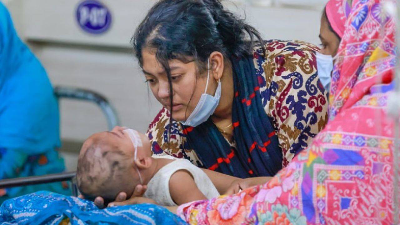 হাম: মারা গেল আরও ১২ শিশু, মৃত্যু ছাড়াল ৪৫০